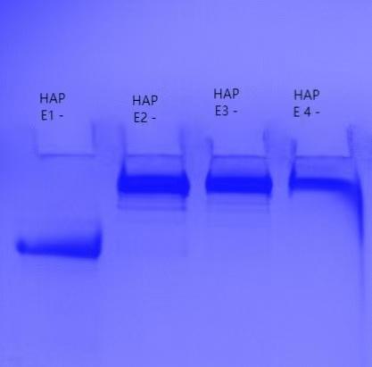figure-2-electrophoresis-profile.jpg figure-2-electrophoresis-profile.jpg